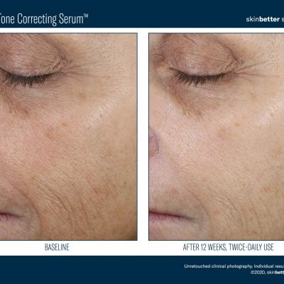 Even Before _ After Template-4