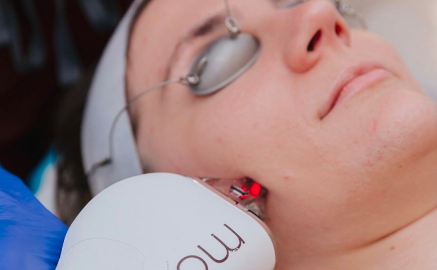 BossGal_Service-Laser-Facials-img-01