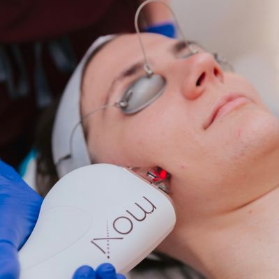 BossGal_Service-Laser-Facials-img-01