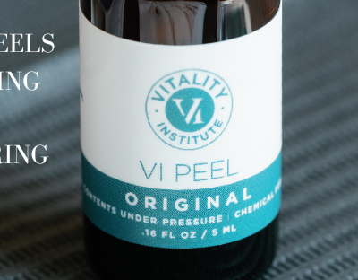 chemical peel for acne