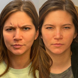 Botox Columbus